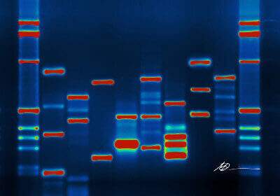 Code Competition 01/2015: DNA Analyse
